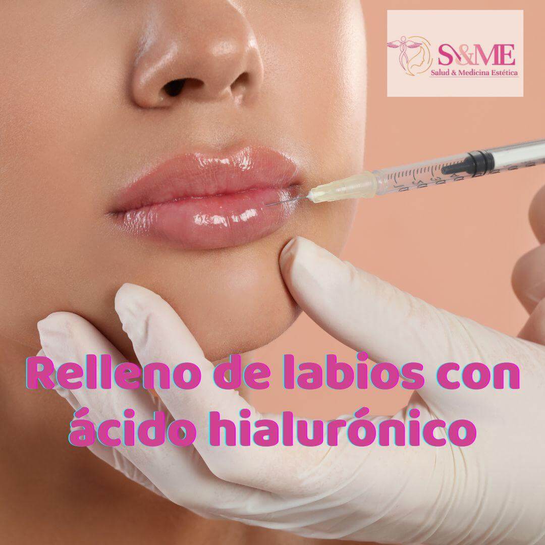 Protocolo antimanchas